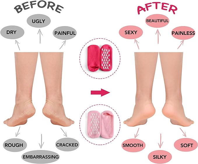 AKRILANE Moisturizing Socks for Women, Spa Gel Socks for Dry Cracked Feet, Softening Rough Feet Gel Lined Infused Lotion Spa Socks