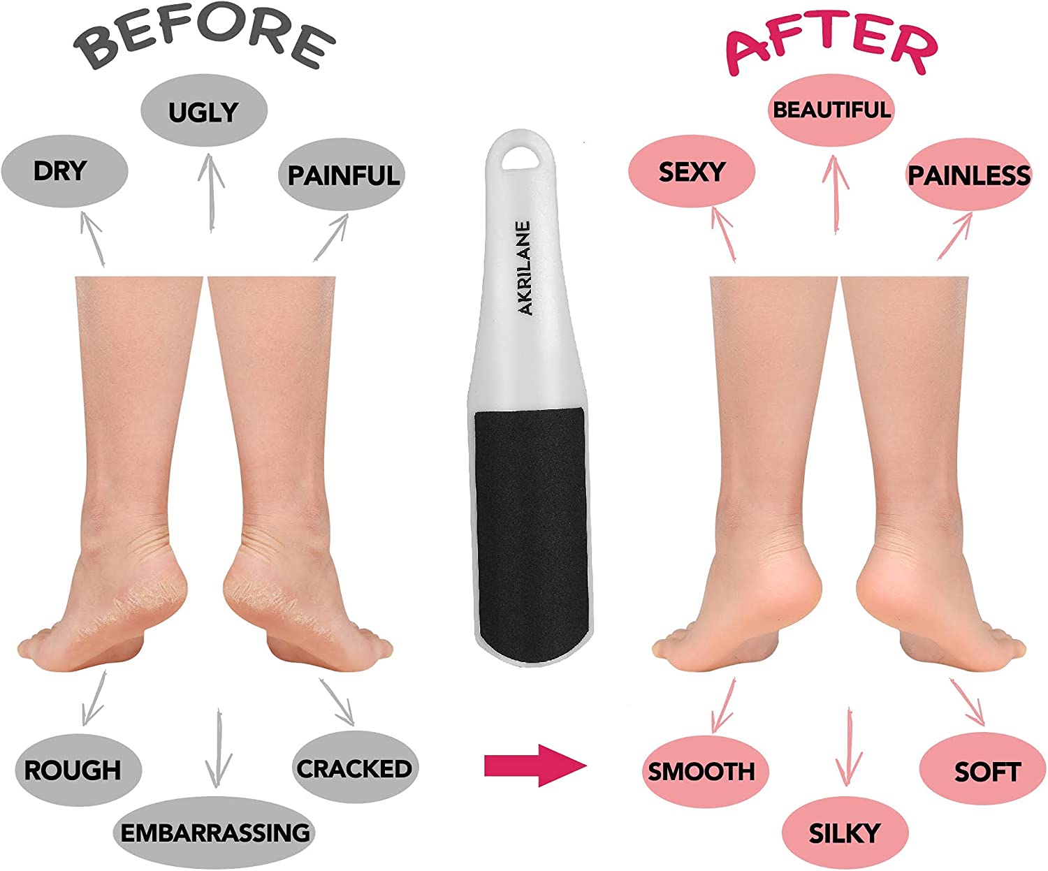 Callus Remover Tool | Pedicure Foot File | Akrilane
