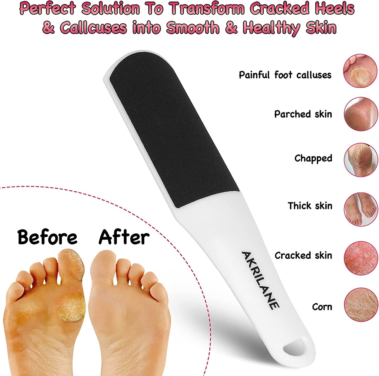 Callus Remover Tool | Pedicure Foot File | Akrilane
